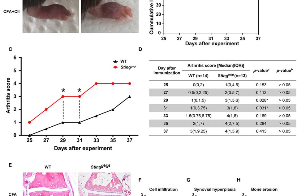 New Article: Deficiency of STING Promotes Collagen-Specific Antibody Production and B Cell Survival in Collagen-Induced Arthritis